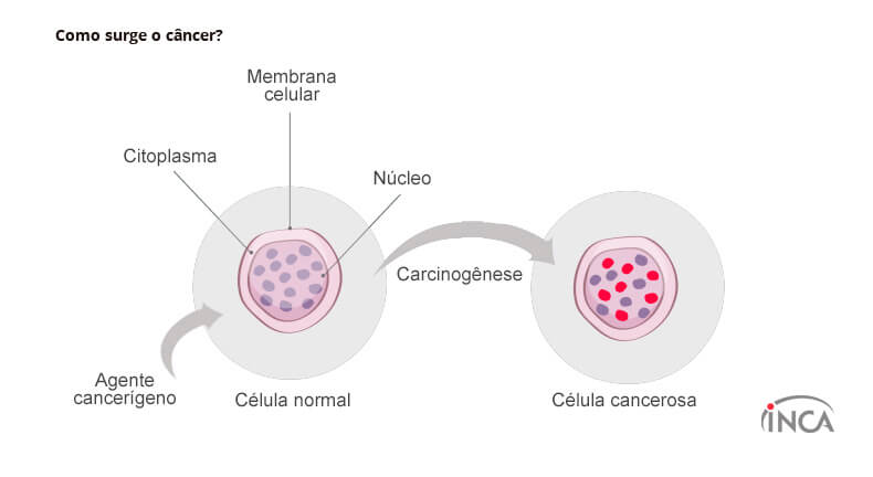 revistaecosdapaz.com - Cientistas americanos descobrem método para impedir que o câncer se espalhe